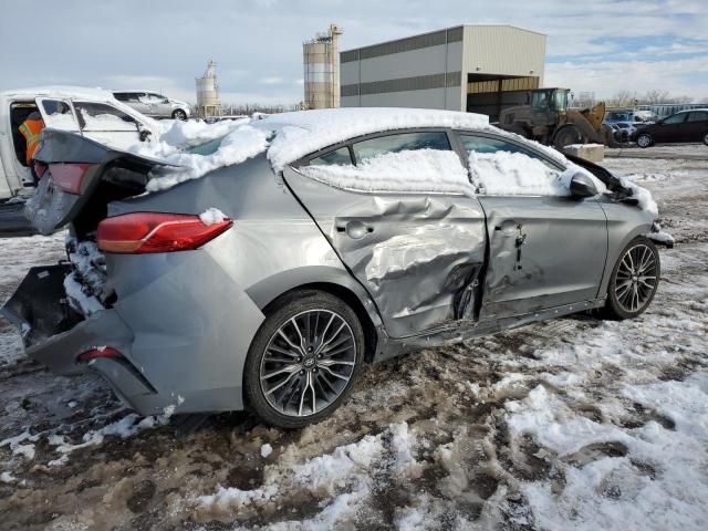 2017 Hyundai Elantra Sport