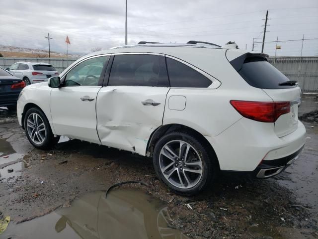 2017 Acura MDX Advance