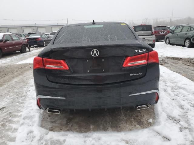 2018 Acura TLX Tech