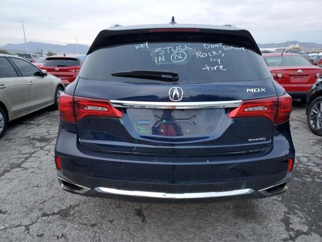 2017 Acura MDX Advance