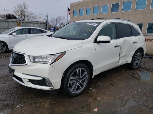 2017 Acura MDX Advance