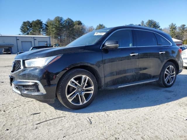 2017 Acura MDX Advance