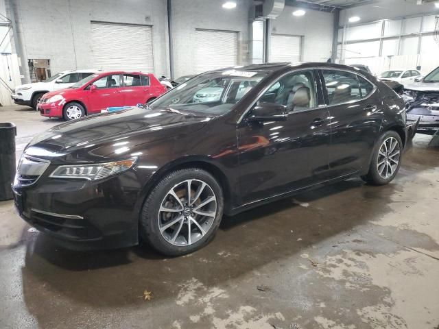 2015 Acura TLX Tech