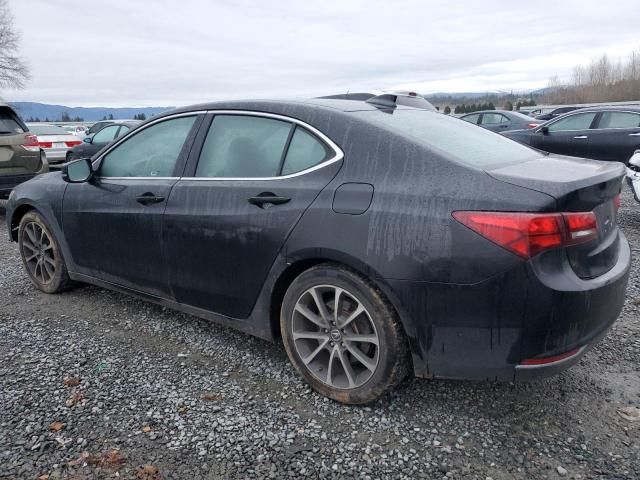 2015 Acura TLX Tech