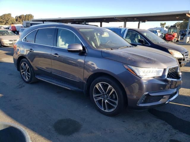 2017 Acura MDX Advance