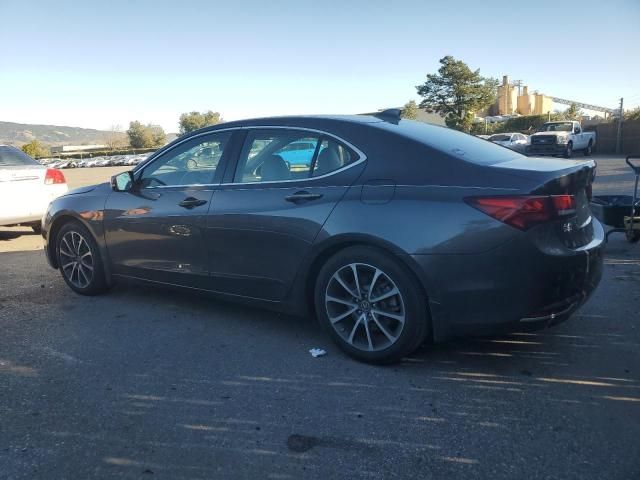 2015 Acura TLX Tech