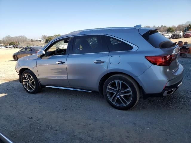 2017 Acura MDX Advance