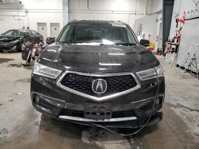 2017 Acura MDX Elite