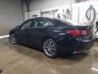 2017 Acura TLX Advance