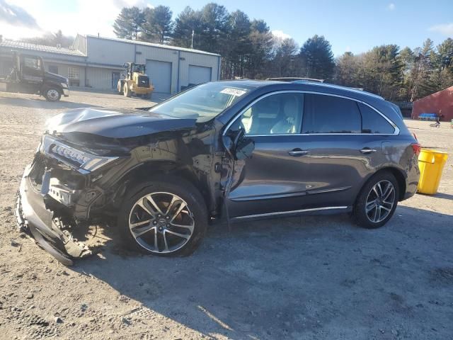 2017 Acura MDX Advance