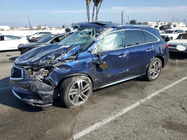 2018 Acura MDX Advance