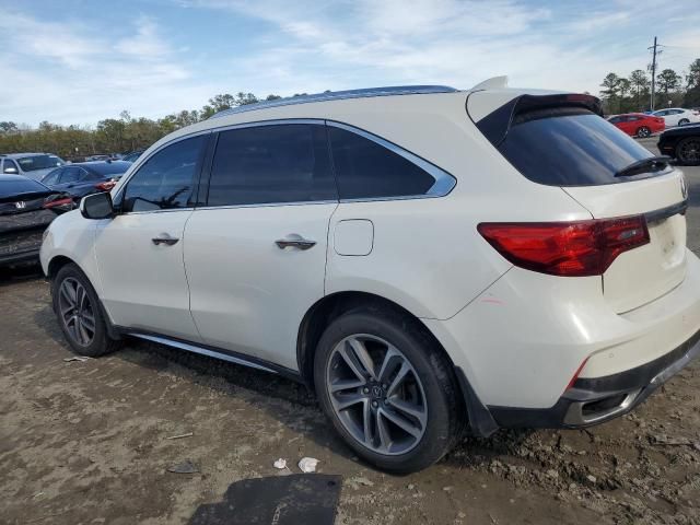 2017 Acura MDX Advance