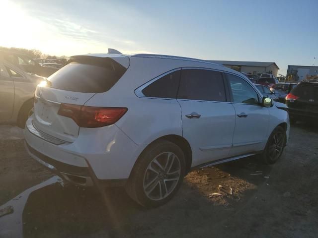 2017 Acura MDX Advance