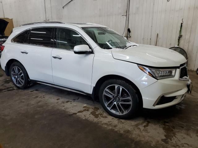 2017 Acura MDX Advance