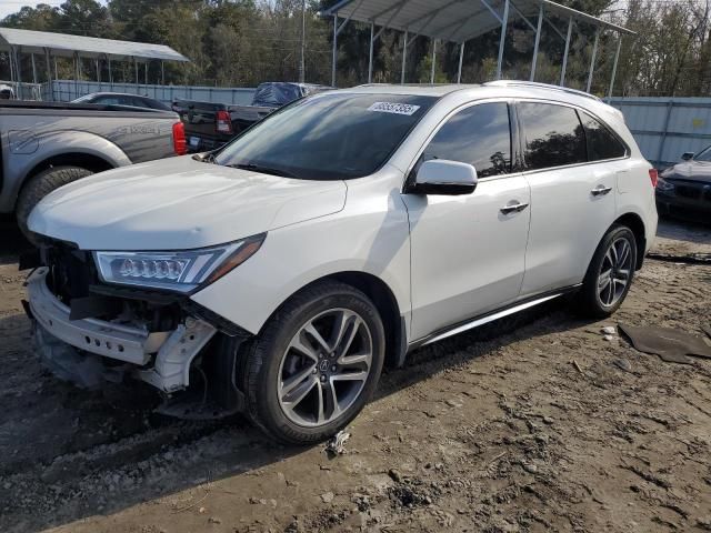 2017 Acura MDX Advance