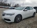 2017 Acura TLX Tech