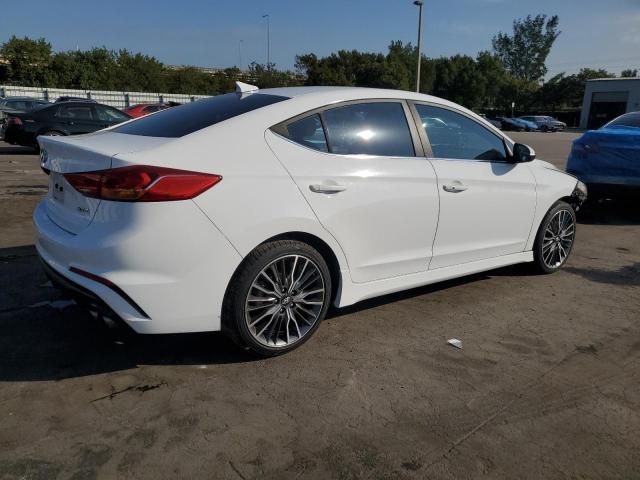 2017 Hyundai Elantra Sport