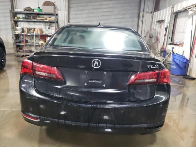 2017 Acura TLX Advance