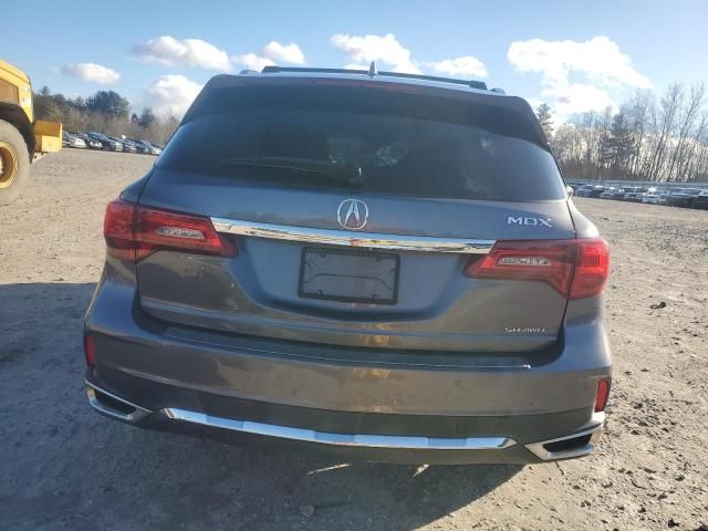 2017 Acura MDX Advance