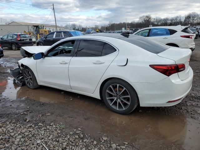 2015 Acura TLX Tech