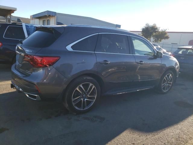 2017 Acura MDX Advance