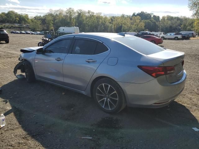 2015 Acura TLX Tech