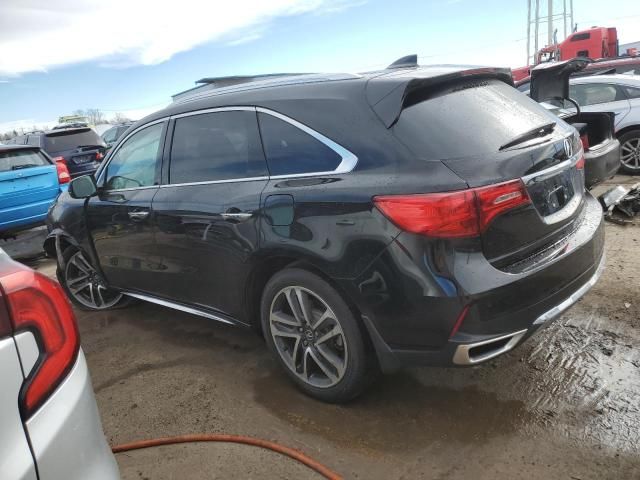 2017 Acura MDX Advance