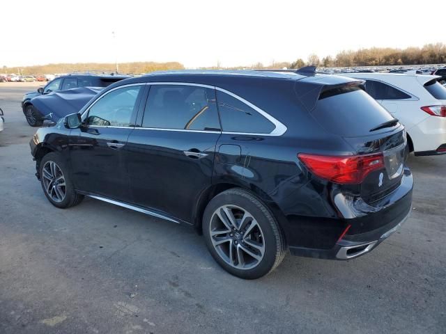 2017 Acura MDX Advance