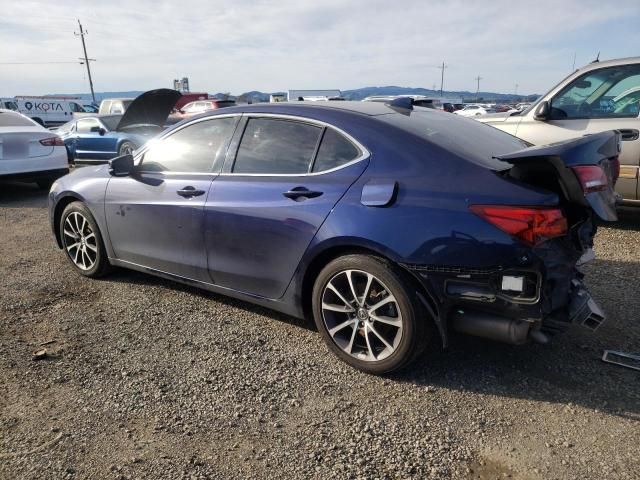 2016 Acura TLX Tech