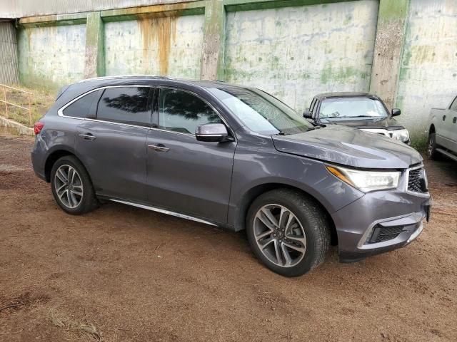 2017 Acura MDX Advance