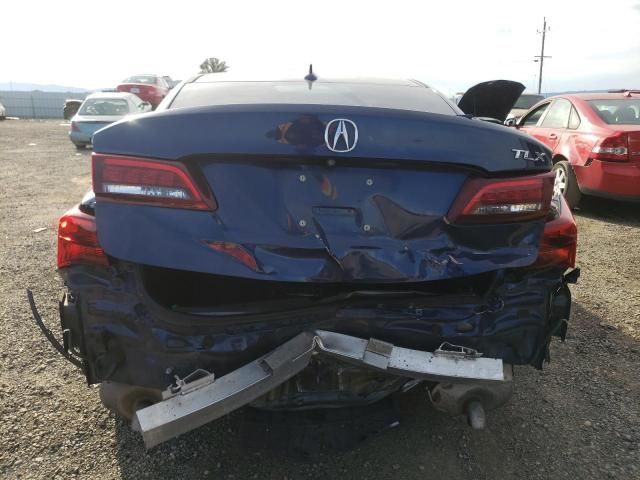 2016 Acura TLX Tech