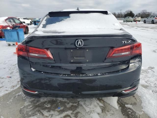 2015 Acura TLX Tech