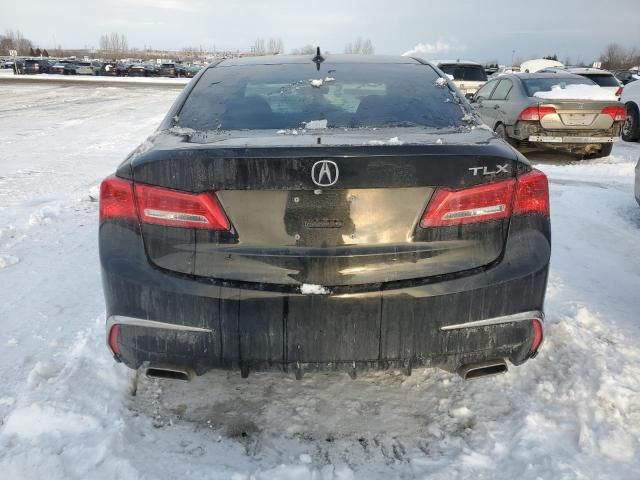 2018 Acura TLX Tech