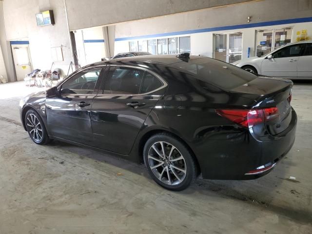 2017 Acura TLX Tech