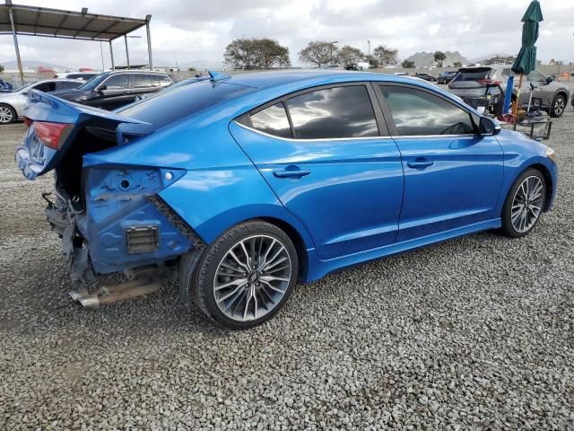 2017 Hyundai Elantra Sport