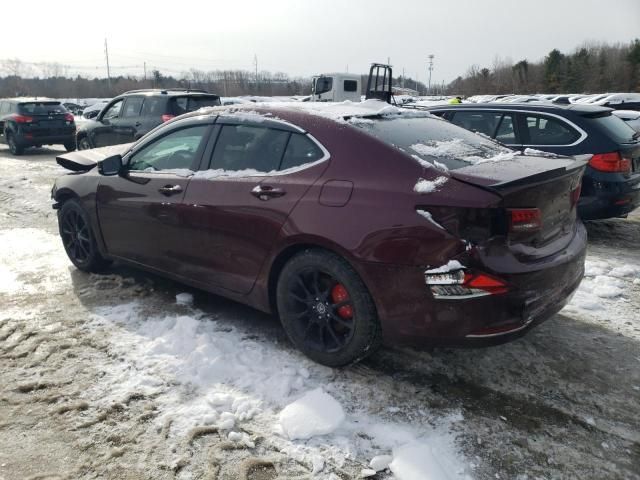 2015 Acura TLX Tech