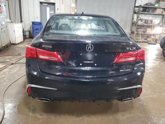 2019 Acura TLX Technology