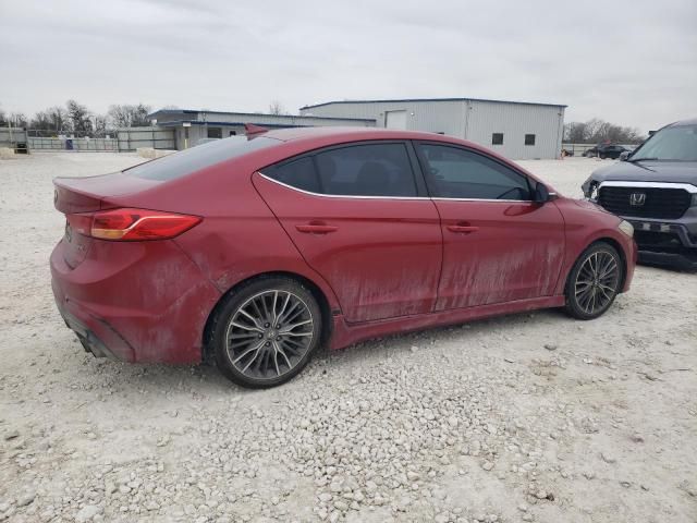 2017 Hyundai Elantra Sport