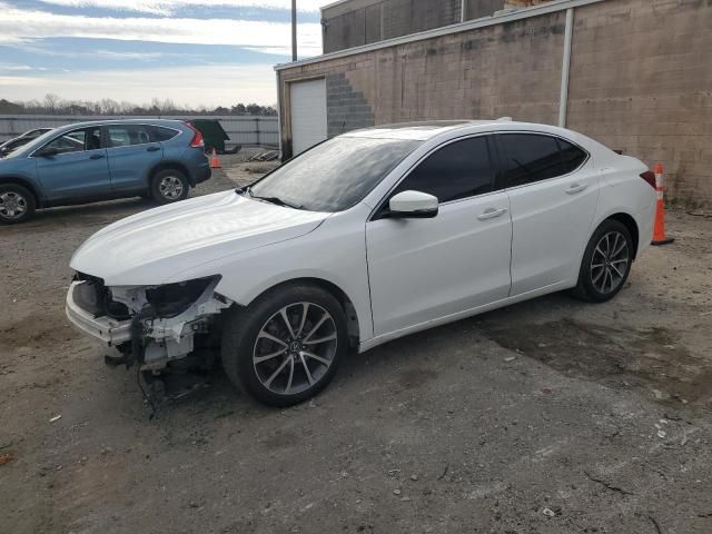 2017 Acura TLX Advance