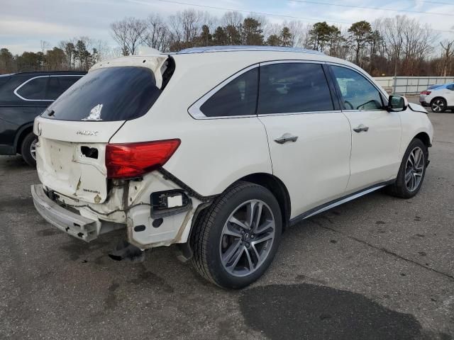 2017 Acura MDX Advance