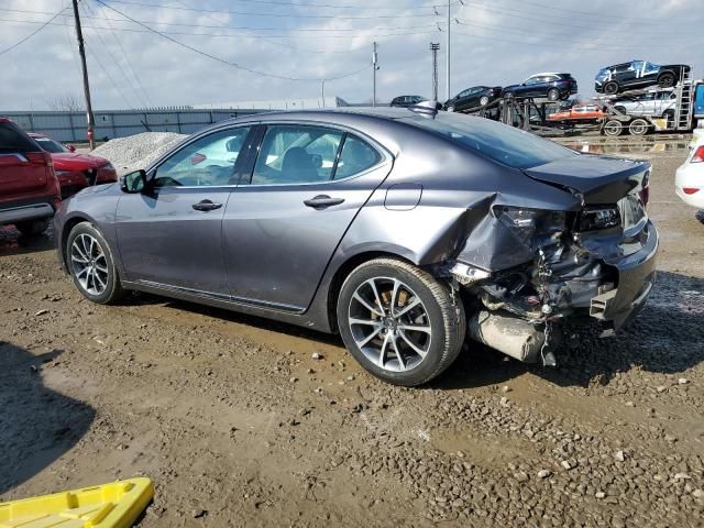 2017 Acura TLX Tech