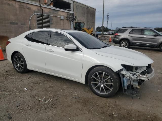 2017 Acura TLX Advance