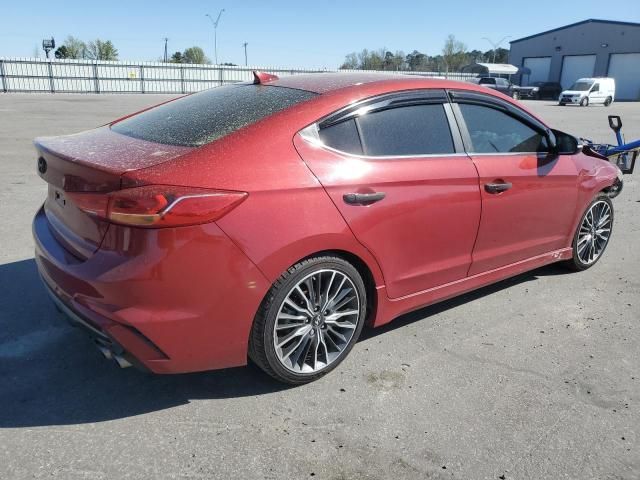 2017 Hyundai Elantra Sport