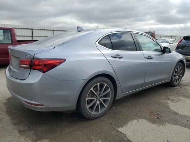 2015 Acura TLX Tech