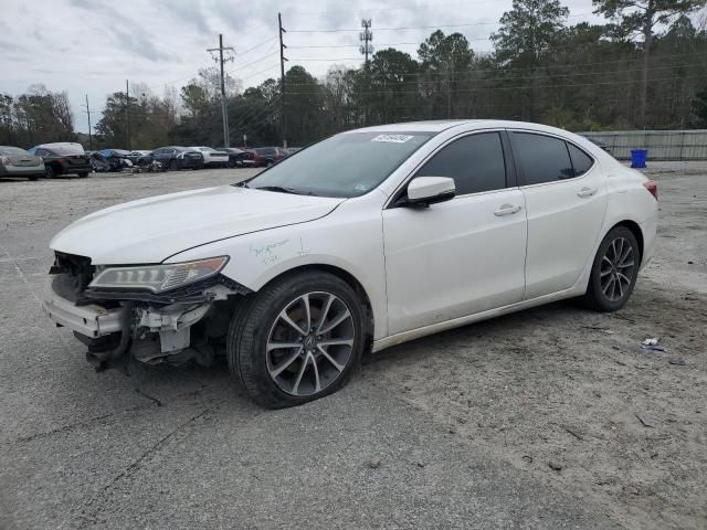 2015 Acura TLX Advance