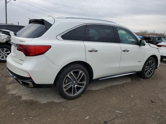 2017 Acura MDX Advance