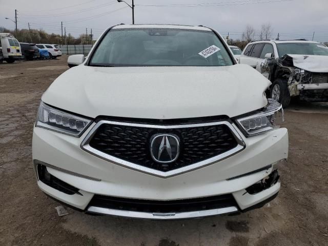 2017 Acura MDX Advance