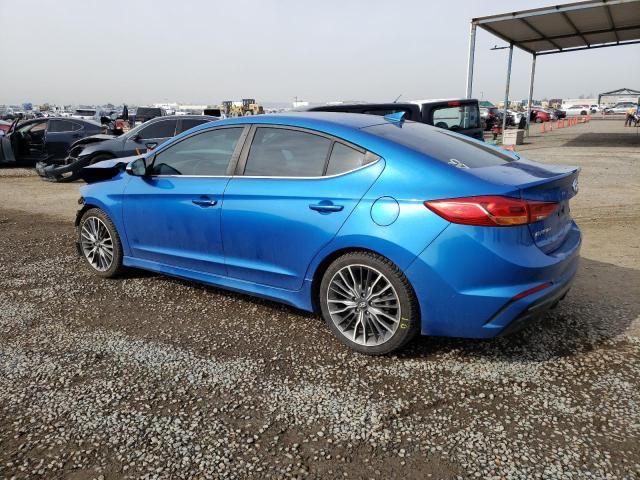 2017 Hyundai Elantra Sport