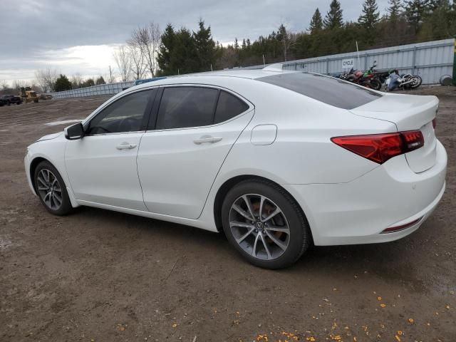 2015 Acura TLX Advance