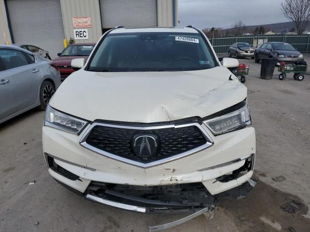 2017 Acura MDX Advance